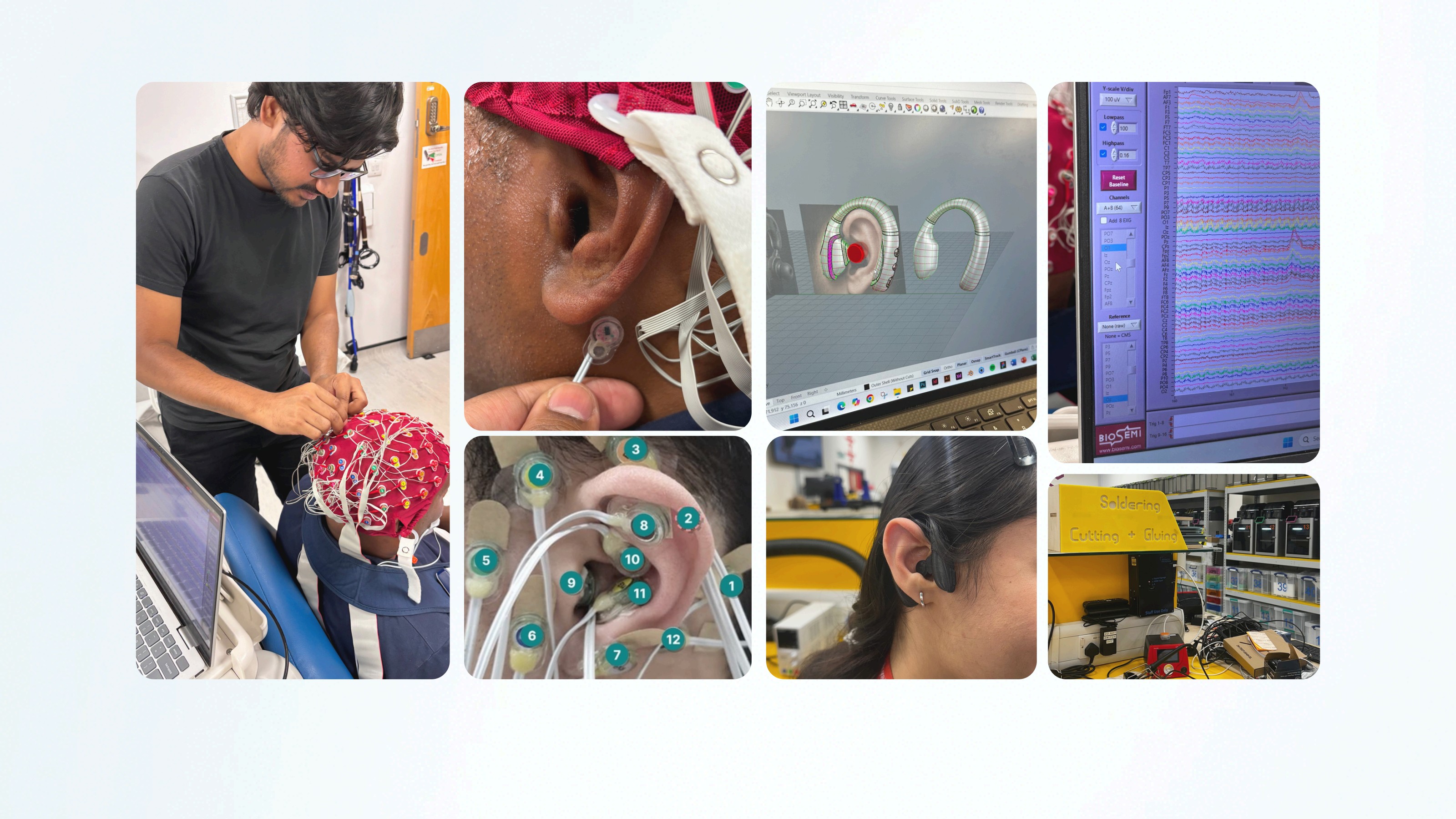 Epile-X research and prototyping